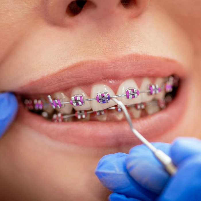 Orthodontic-income-Factors-affecting-income
